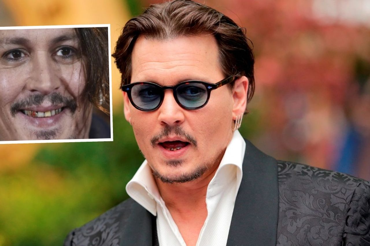 Does Johnny Depp Have A Rotten Teeth Johnny Depp Teeth Before And After   Fecbad18 C0e2 11ed 9449 0210609a3fe2 