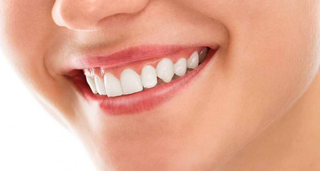 smile makeover 1500x800 1